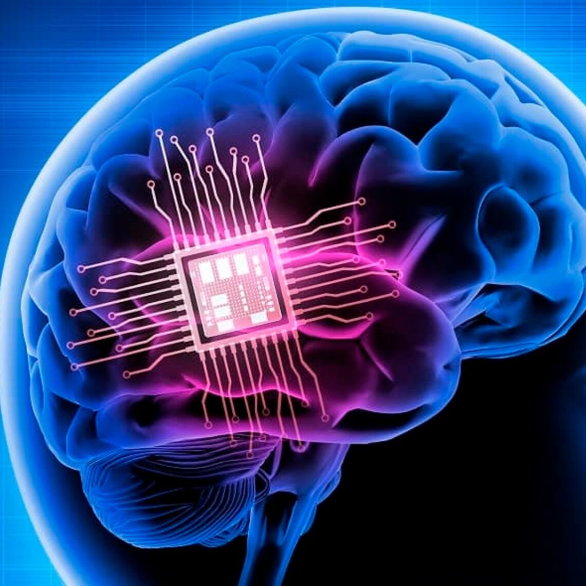 chip cerebro
