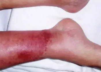 Foto: Reprodução da internet