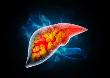 Corpo apresenta sinais de gordura no fígado e muitos brasileiros ignoram