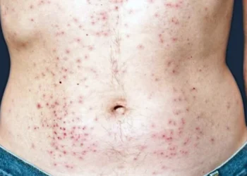 Foto: Reprodução da internet