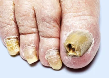 Foto: Reprodução da internet)